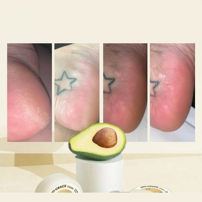 Winter Anti-Cracking Frost - Image 12