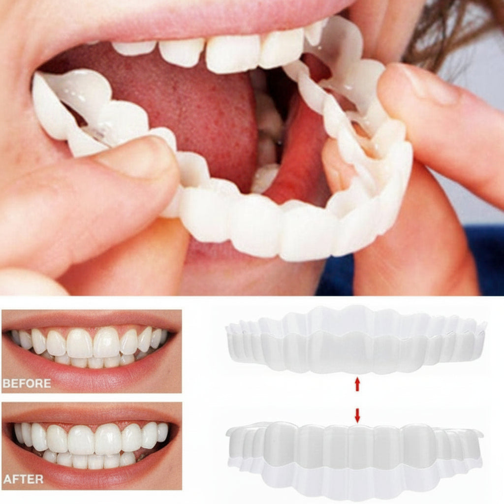Smile Veneer (Upper & Lower Included) - Image 9