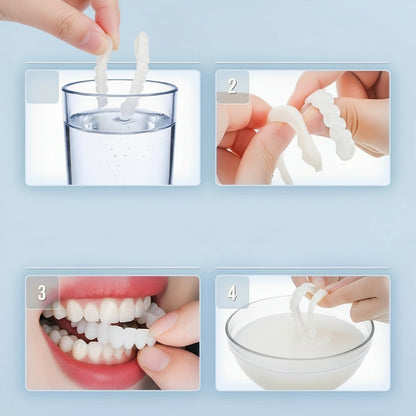 Smile Veneer (Upper & Lower Included) - Image 7